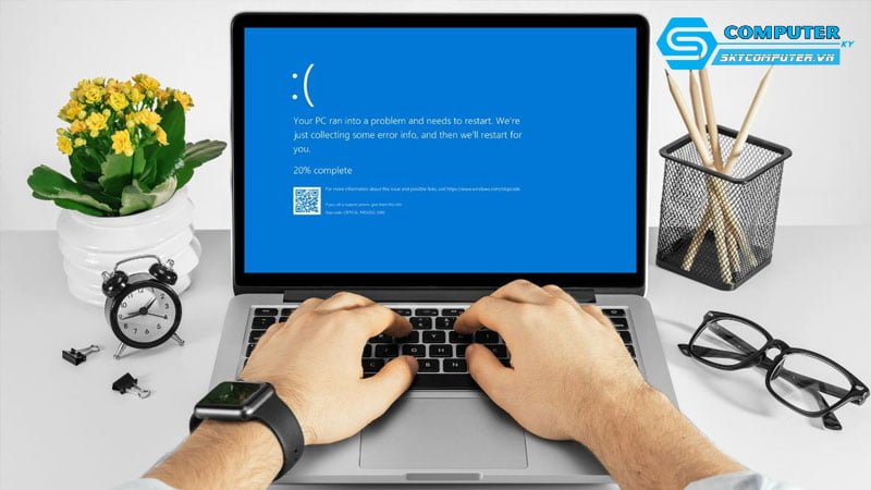 nhung-loi-hu-hong-laptop-thuong-gap-skycomputer