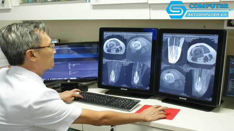 May-tinh-de-ban-va-cong-nghe-xu-ly-du-lieu-hinh-anh-trong-y-hoc-1